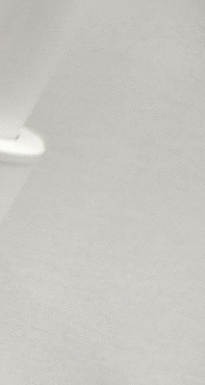 치아 사이 벌어짐 심해지는 이유부터 알아보면 관련 이미지 18