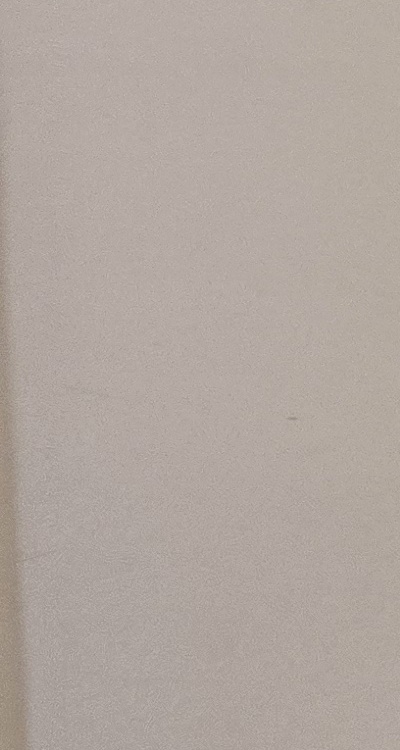 앞니 올세라믹 이건 알고 시작하세요 관련 이미지 30