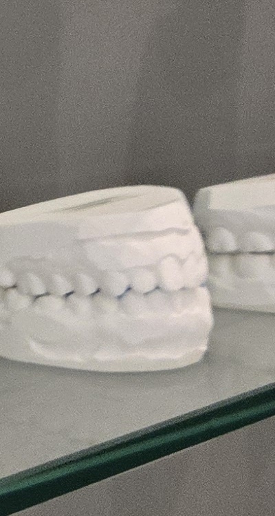 사랑니 주변 잇몸 통증 지금부터가 중요하니까 관련 이미지 38