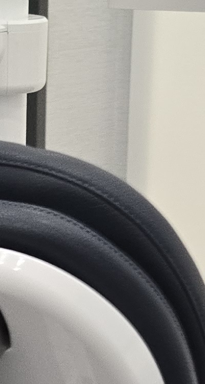 어금니 임플란트 안하면 후회하게 되는걸까 관련 이미지 18