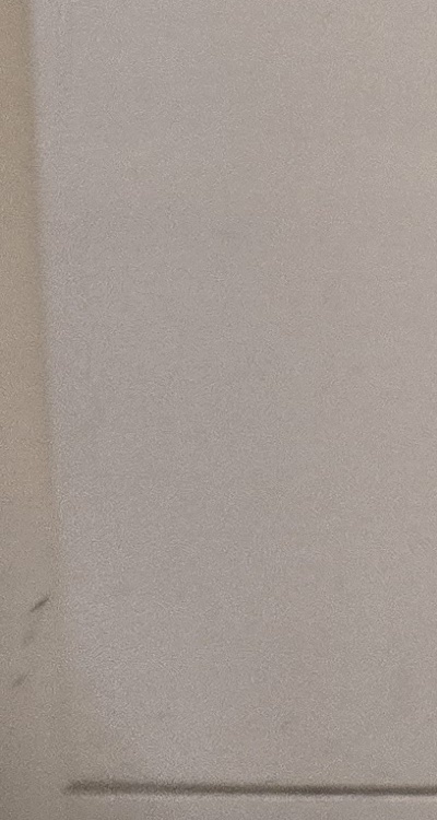 앞니 올세라믹 이건 알고 시작하세요 관련 이미지 40