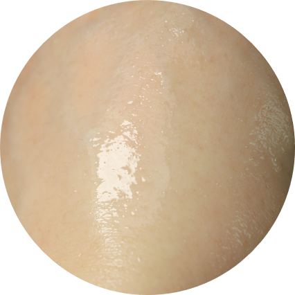 여드름피부 클렌징 살리실산으로 개운하게 마무리 관련 이미지 11