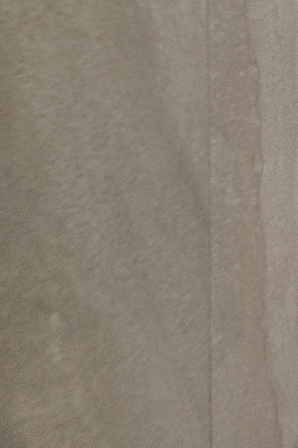 어금니 임플란트 과정 제대로 이해하려면 관련 이미지 27