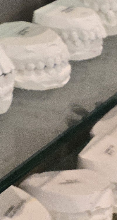 사랑니 주변 잇몸 통증 지금부터가 중요하니까 관련 이미지 49