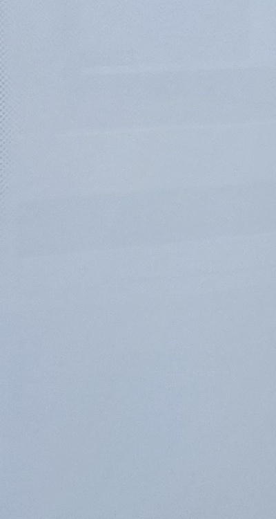 사랑니 발치 후 충치 치료 둘다 준비하려면 관련 이미지 34