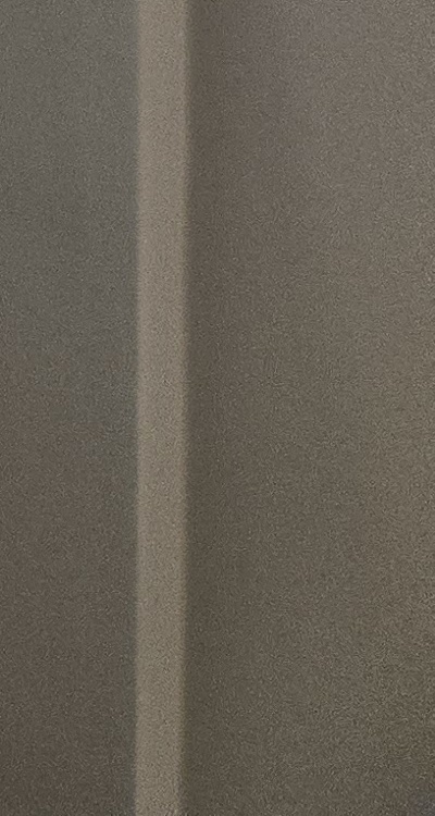 앞니 틀어짐 부분교정 얼마나 걸릴까 관련 이미지 50