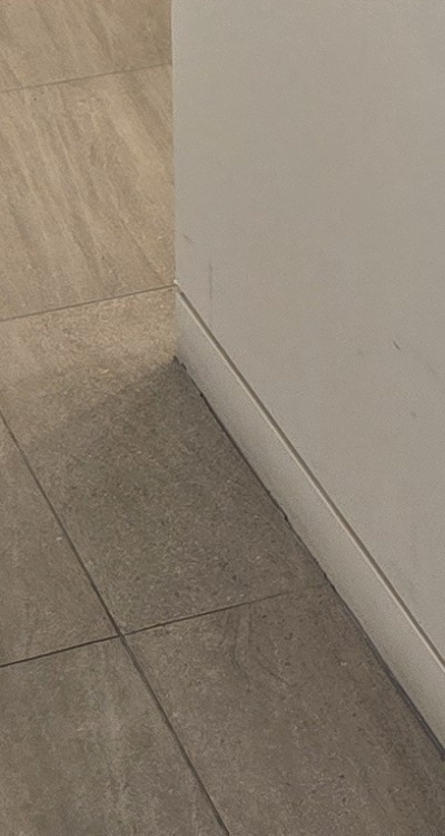 앞니 부분 교정 간단하니까 좋은건가요 관련 이미지 47