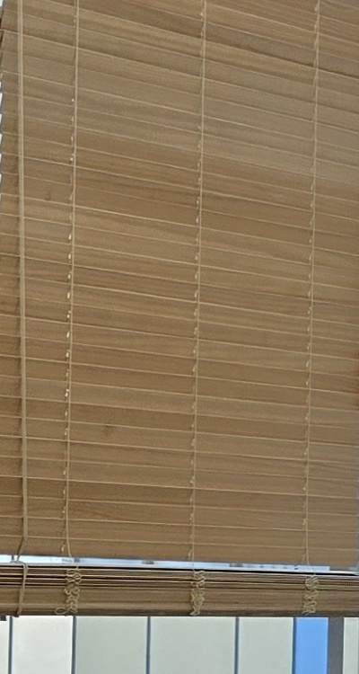 돌출입 팔자주름 교정 얼마나 바뀔까요 관련 이미지 25