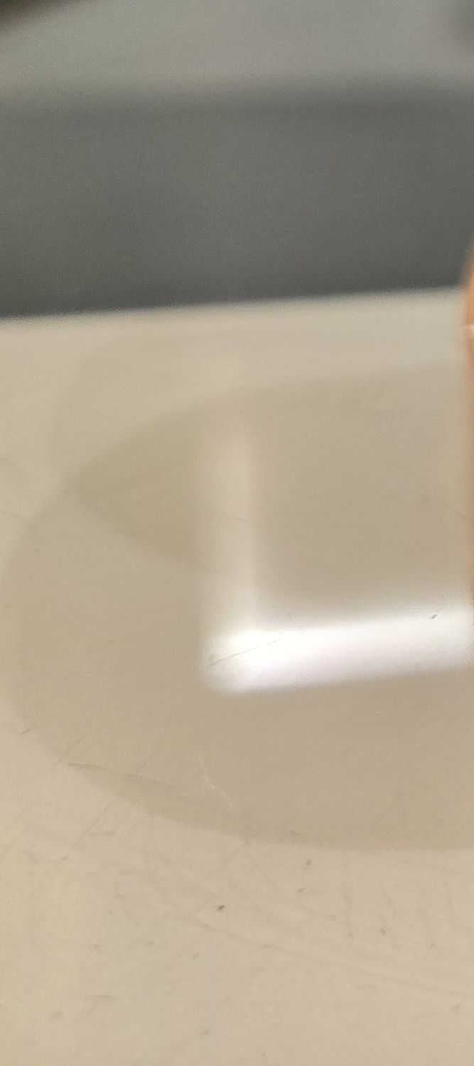 송곳니 덧니 발치 이럴때 해당되네요 관련 이미지 19