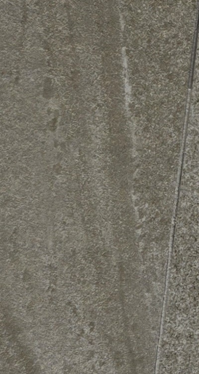 앞니 신경치료 크라운 까지 해야할 상황이라면 관련 이미지 32