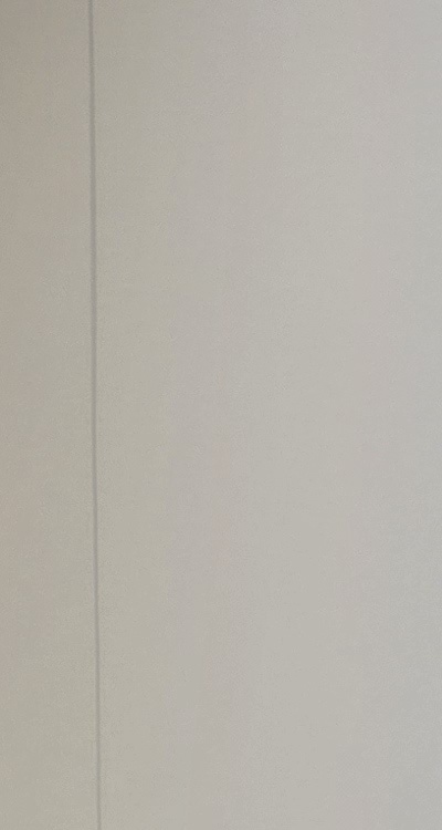 앞니 부분 교정 간단하니까 좋은건가요 관련 이미지 18