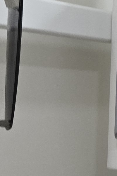 부정교합 교정 안하면 생기는 문제는 뭔가요 관련 이미지 32