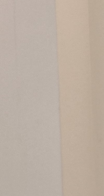 앞니 올세라믹 이건 알고 시작하세요 관련 이미지 21