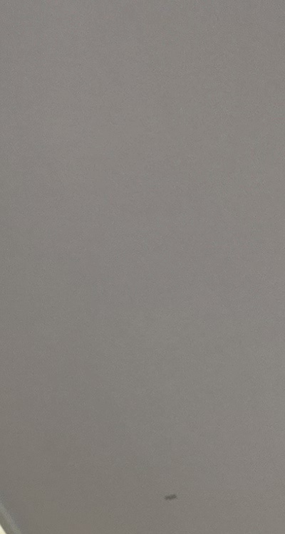 앞니 신경치료 크라운 까지 해야할 상황이라면 관련 이미지 19