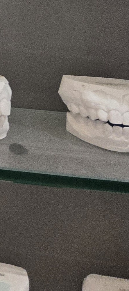 앞이빨 임플란트 과정 주의해야할 포인트는 관련 이미지 34