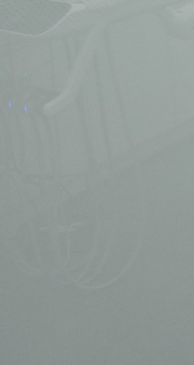 충치 검은점 나타났다면 이렇게 대처해요 관련 이미지 33