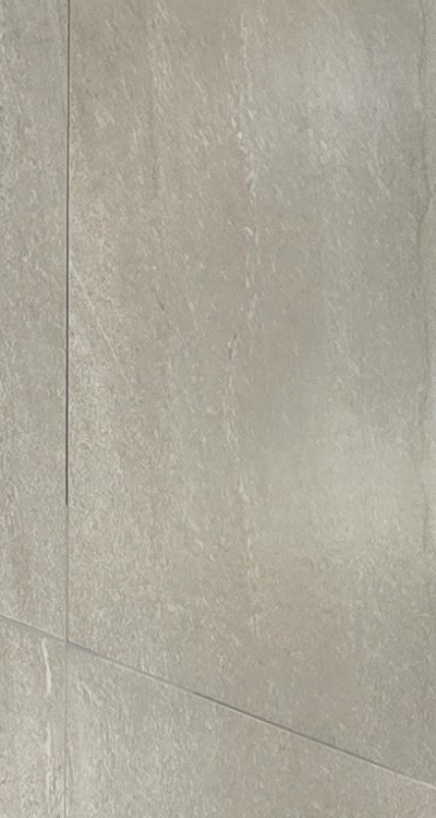 임플란트의 장점 할까 말까 고민이신 분들을 위한 정리 관련 이미지 15