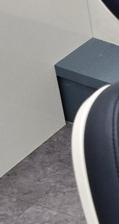 치아 사이 벌어짐 심해지는 이유부터 알아보면 관련 이미지 20