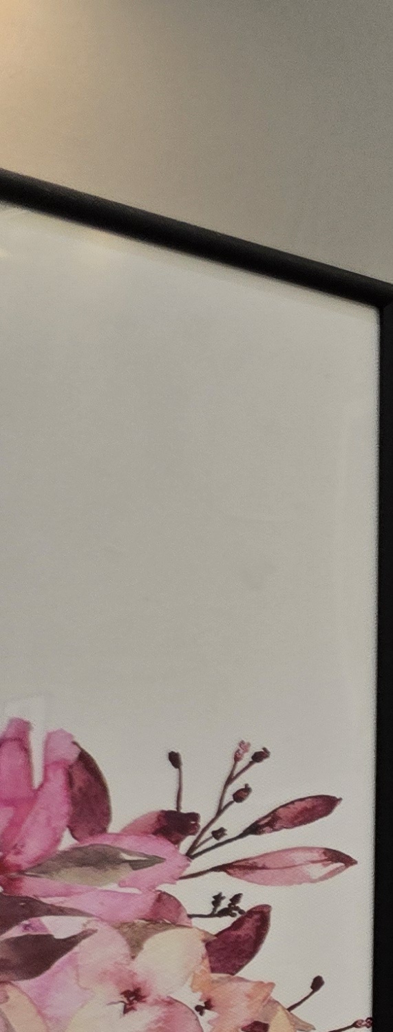 비발치 돌출입 교정 어떨때 적절할까 관련 이미지 22