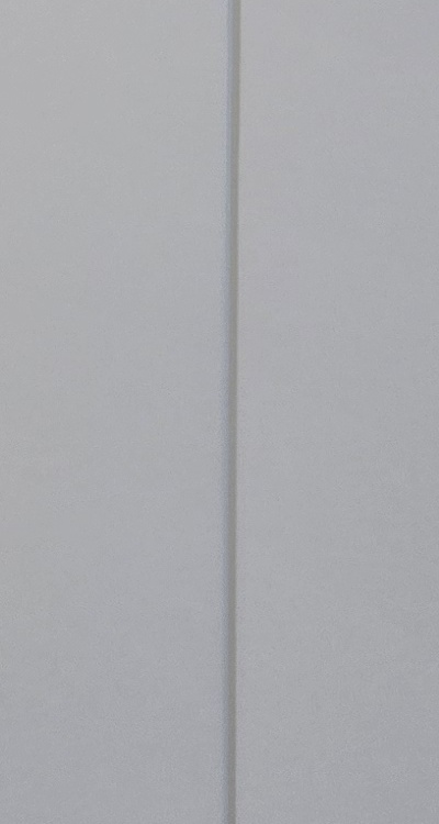 앞니 부분 교정 간단하니까 좋은건가요 관련 이미지 40