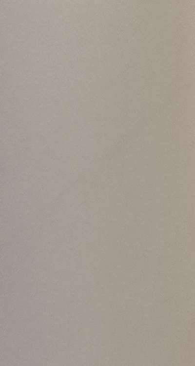 앞니 부분 교정 간단하니까 좋은건가요 관련 이미지 33