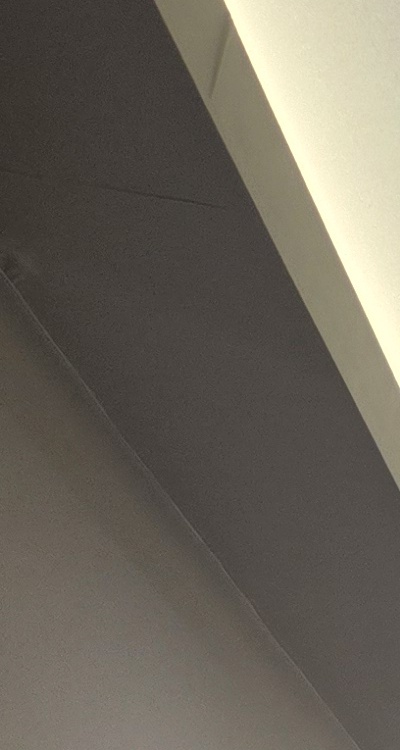 반대교합 치아교정 해결 가능할까 관련 이미지 18