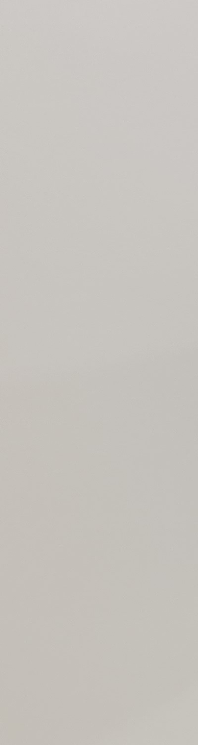 앞니 크라운 교체 깔끔하게 정리하려면 관련 이미지 11