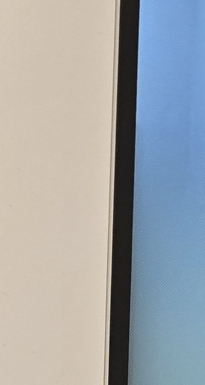 앞니 올세라믹 이건 알고 시작하세요 관련 이미지 26