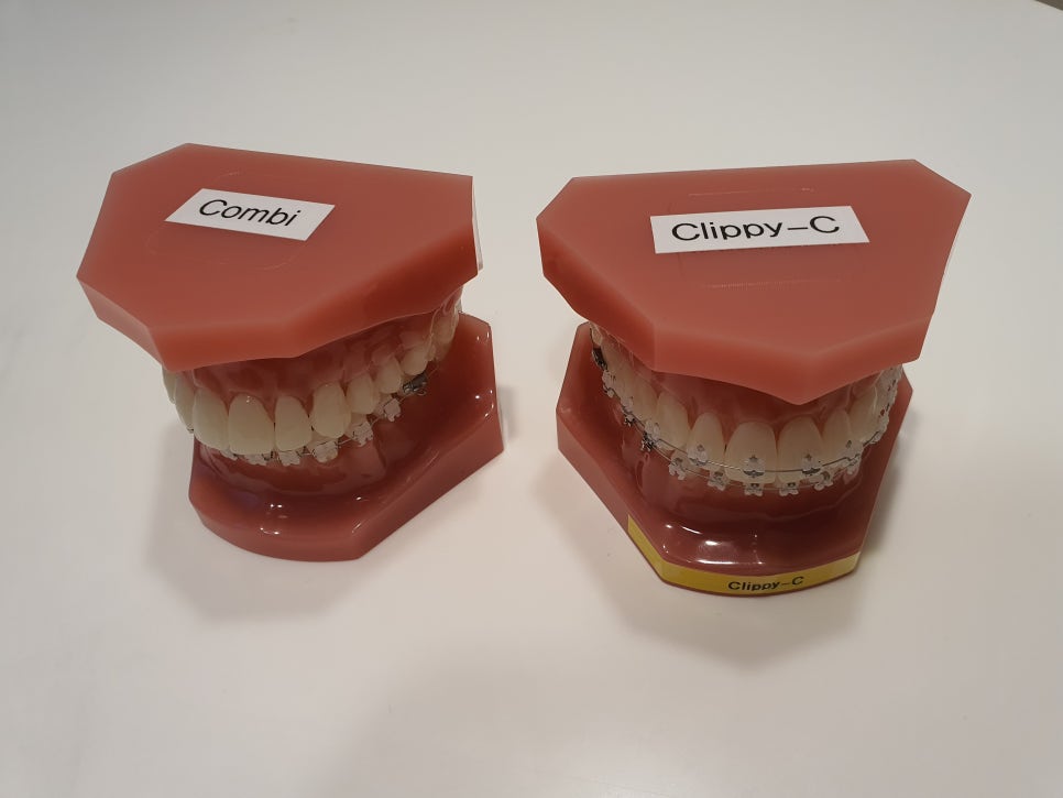 클리피씨교정 알아볼 때 꼭 신경 써야 하는 점은! 관련 이미지 14