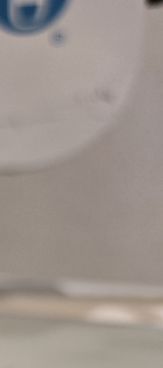 송곳니 덧니 발치 이럴때 해당되네요 관련 이미지 29