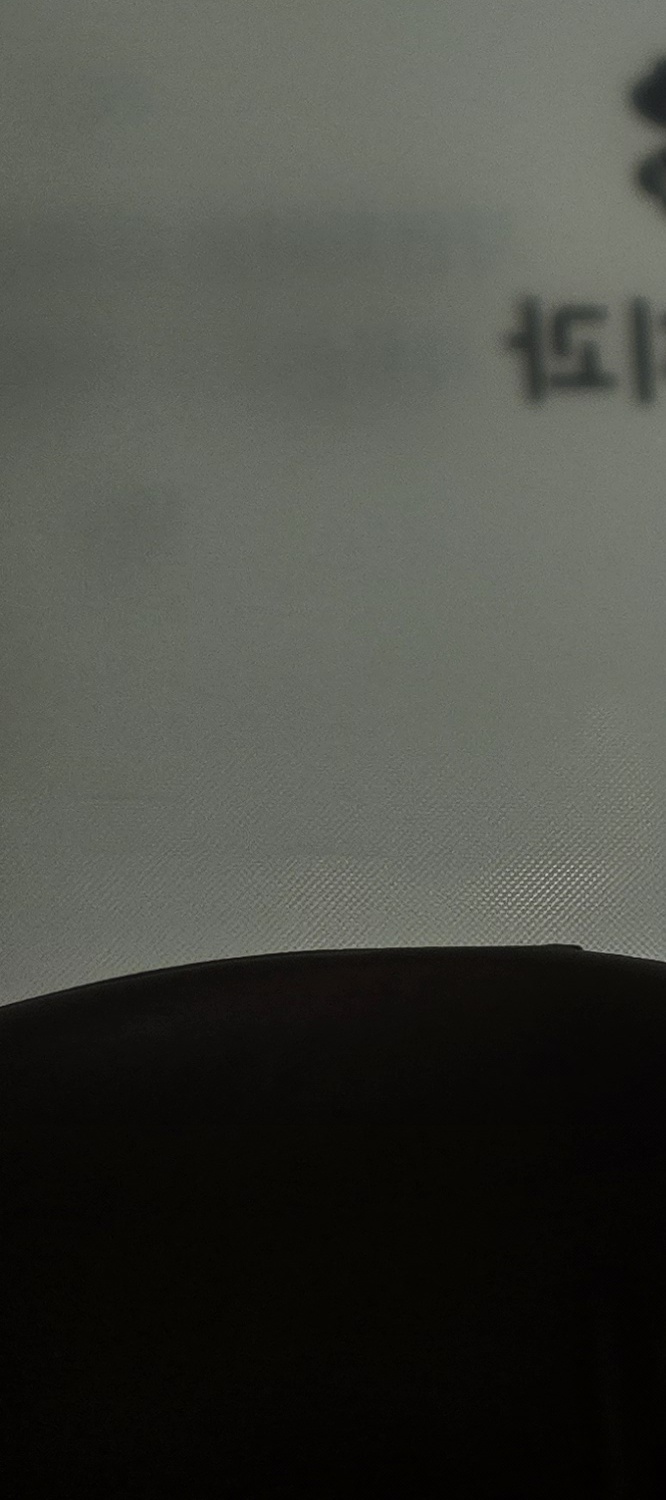금 크라운 수명 몇년이나 지속될까요 관련 이미지 17