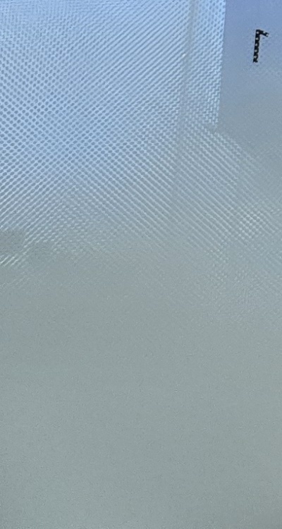 인레이 치료 후 통증 자꾸 심해지는데 괜찮은걸까 관련 이미지 42