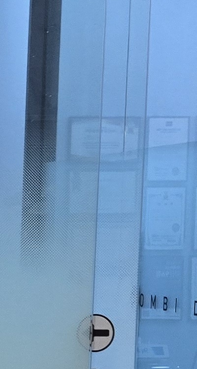 앞니 올세라믹 이건 알고 시작하세요 관련 이미지 27