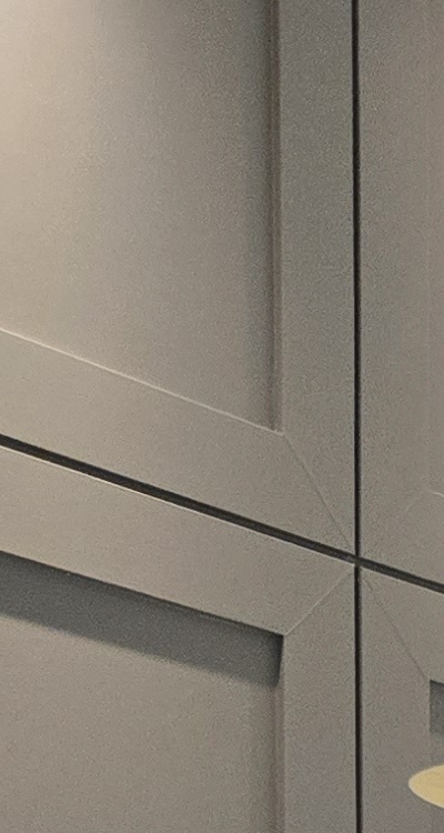 아래 사랑니 발치 통증 미리 알고 대처하려면 관련 이미지 11