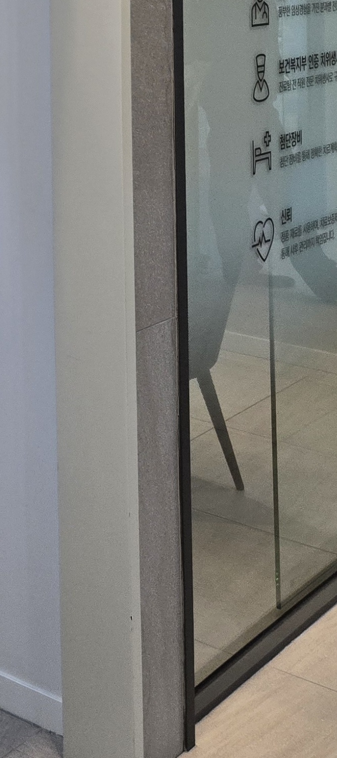 무치악 임플란트 과정 상세하게 알아보면 관련 이미지 36
