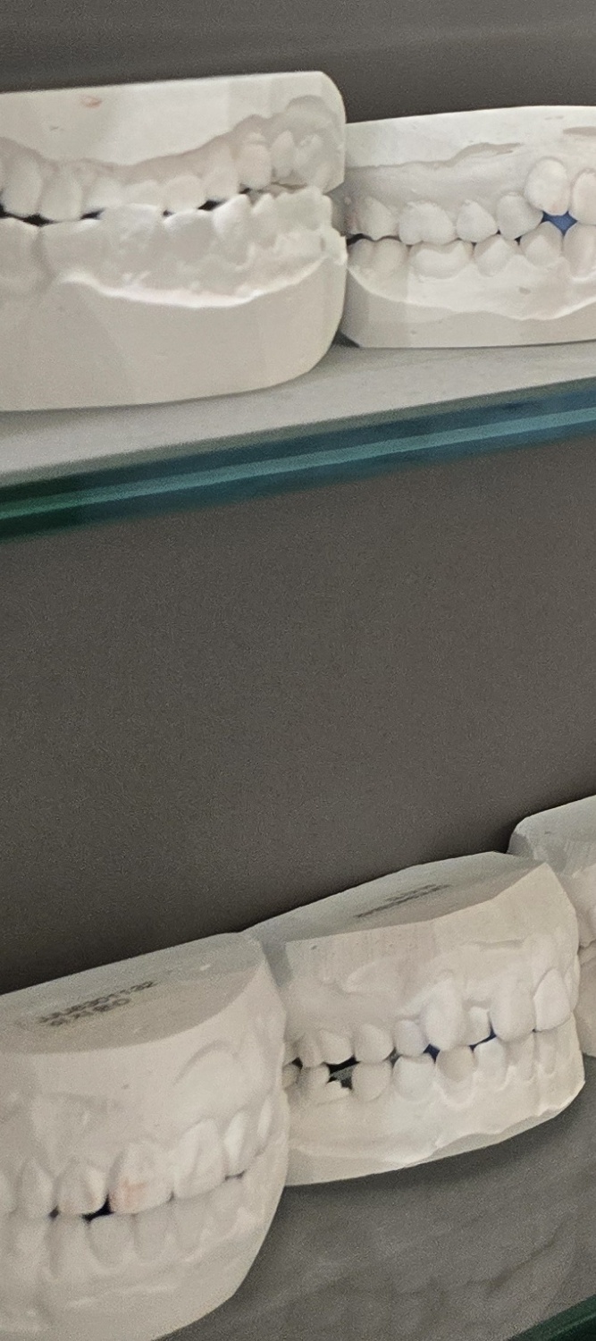 돌출 앞니 교정 이렇게 준비하세요 관련 이미지 29