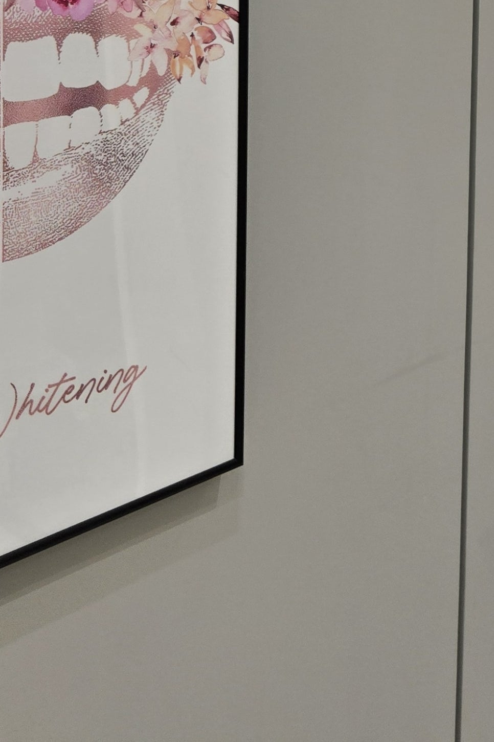 부분매복 사랑니 발치 신중하게 대비하려면 관련 이미지 28