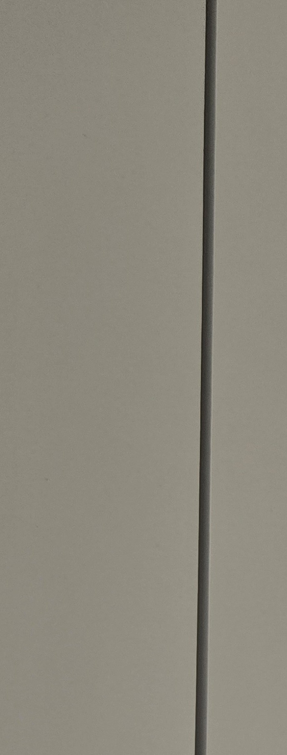 비발치 돌출입 교정 어떨때 적절할까 관련 이미지 24