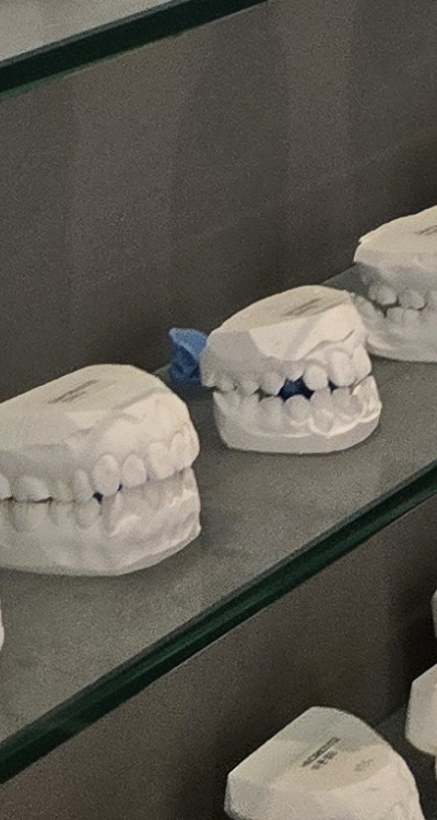 완전매복사랑니 발치 대학병원 꼭 가야하나요 관련 이미지 44