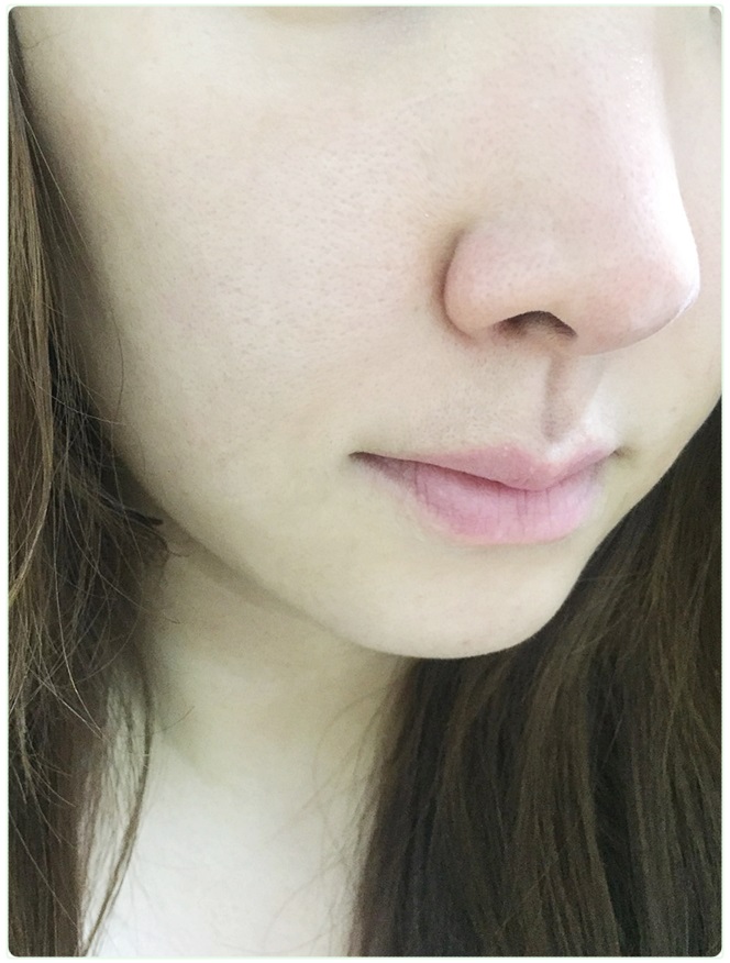 얼굴 피지 관리 필요한 시기! 관련 이미지 6