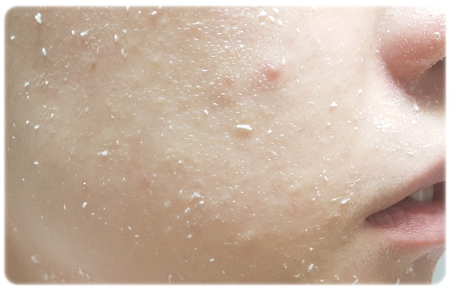 얼굴각질관리 꿀팁전수! 관련 이미지 6