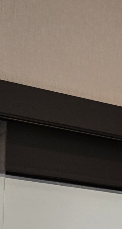 인레이 치료 후 통증 자꾸 심해지는데 괜찮은걸까 관련 이미지 25