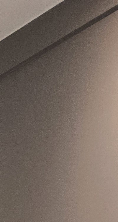 인레이 치료 후 통증 자꾸 심해지는데 괜찮은걸까 관련 이미지 19