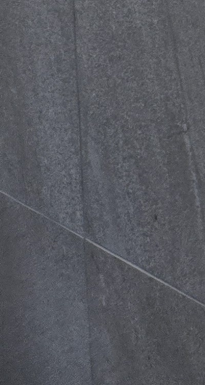 임플란트의 장점 할까 말까 고민이신 분들을 위한 정리 관련 이미지 40