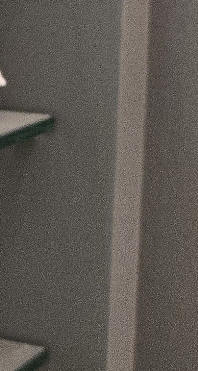 사랑니 주변 잇몸 통증 지금부터가 중요하니까 관련 이미지 41