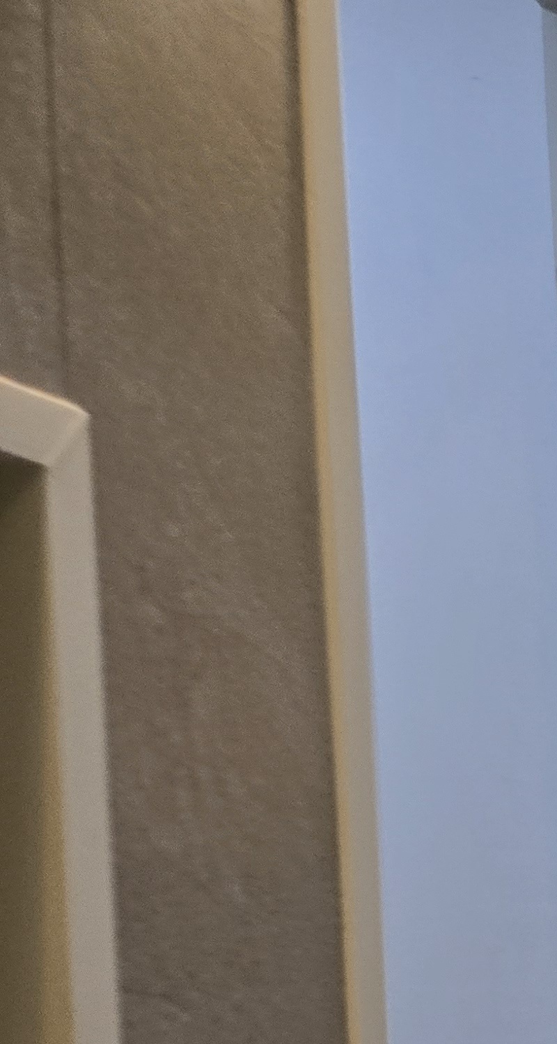 어금니 충치 단계 미리 알아차리려면 관련 이미지 25