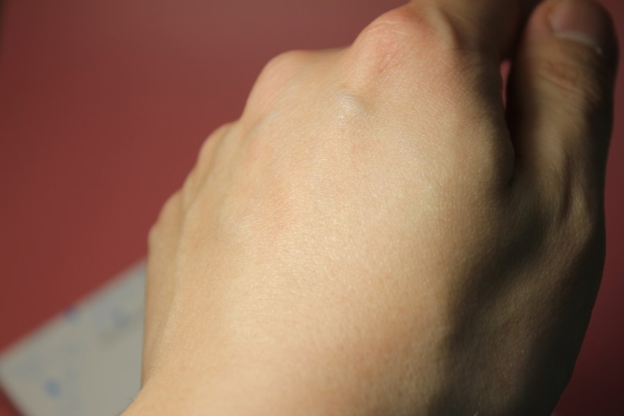 병원화장품 민감성 피부에게는 딱인 쎄라덤몰 관련 이미지 9