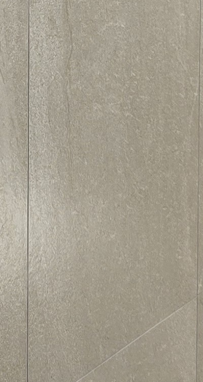 임플란트의 장점 할까 말까 고민이신 분들을 위한 정리 관련 이미지 35