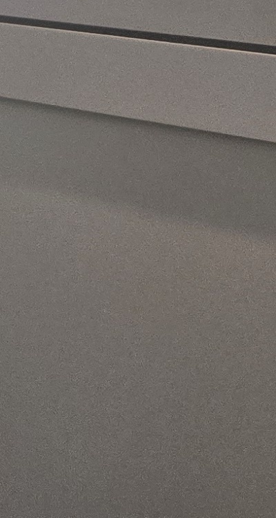 인레이 치료 후 통증 자꾸 심해지는데 괜찮은걸까 관련 이미지 47