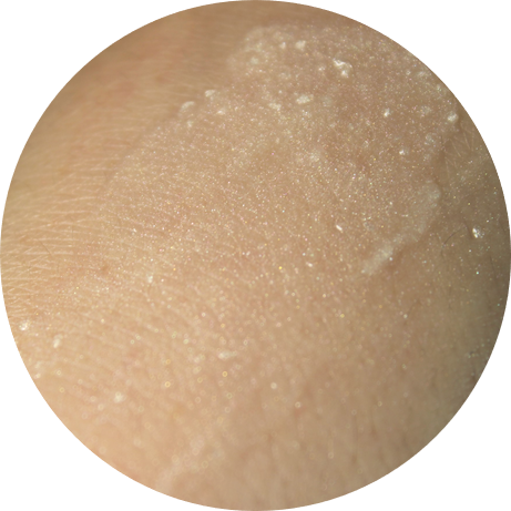 눈가주름 개선이 필요할때 환해지는 메조필라 아이세럼^^ 관련 이미지 12